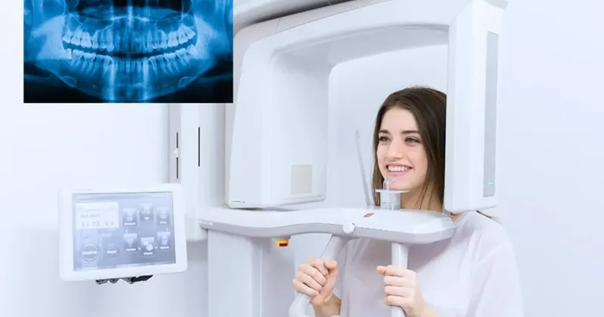 What Is an OPG X-Ray? Guide to Panoramic Dental Imaging