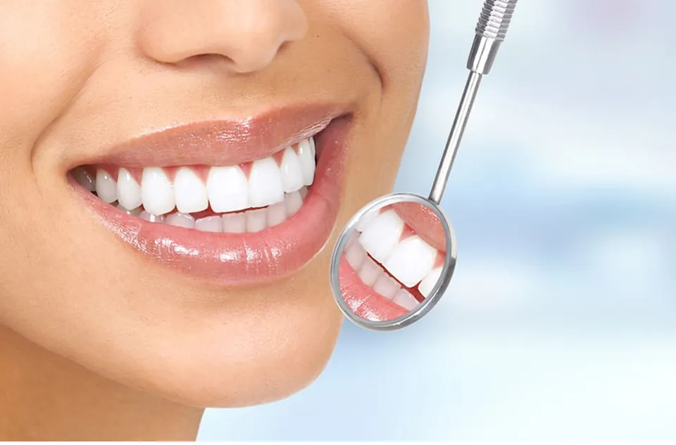 Hollywood Smile: Veneers vs. Implants – What’s Right for You?