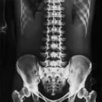 Spine X-Ray procedure at DCDC Dubai Healthcare City