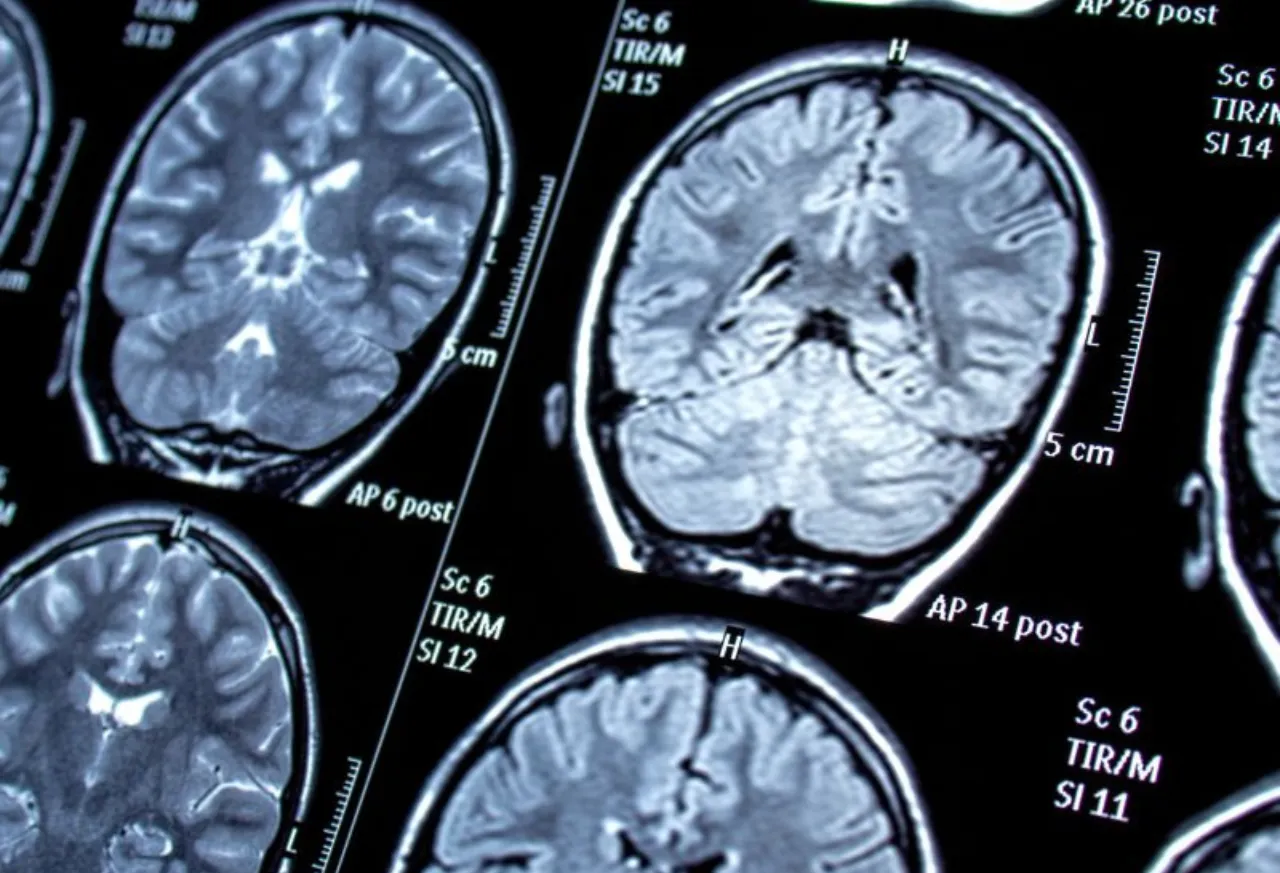 You are currently viewing Comprehending Seizures: Origins, Signs, and Management