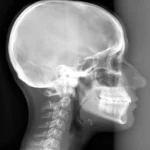 Head X-ray