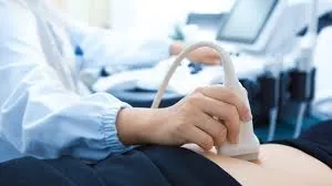 What Is a Doppler Ultrasound? How It Works Simply