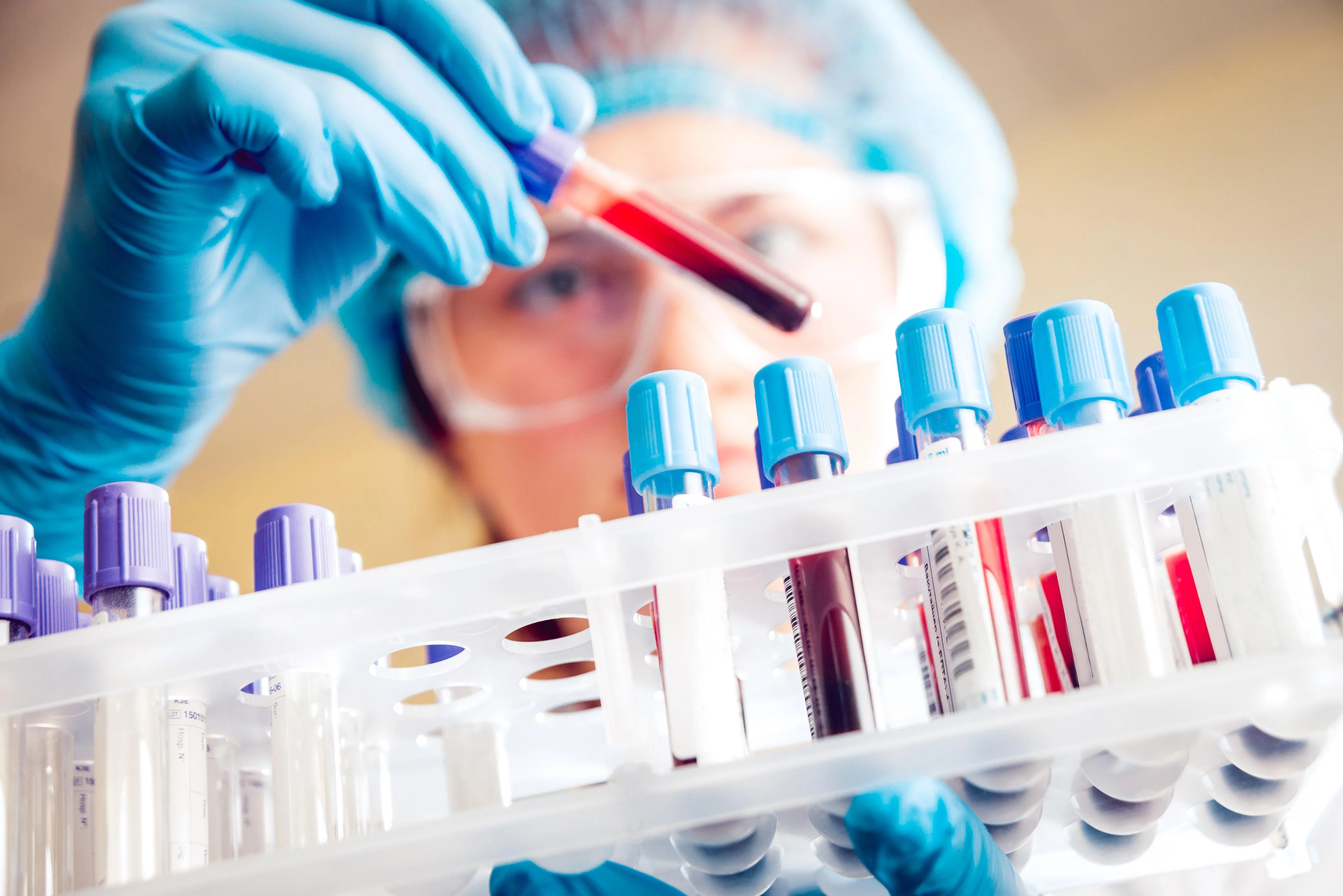 Pre-Surgery Tests Dubai: What You Need (2026)