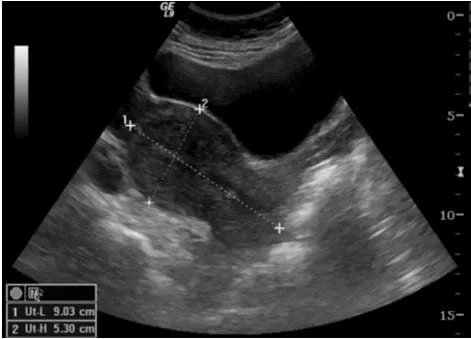 Ultrasound at Home - DCDC