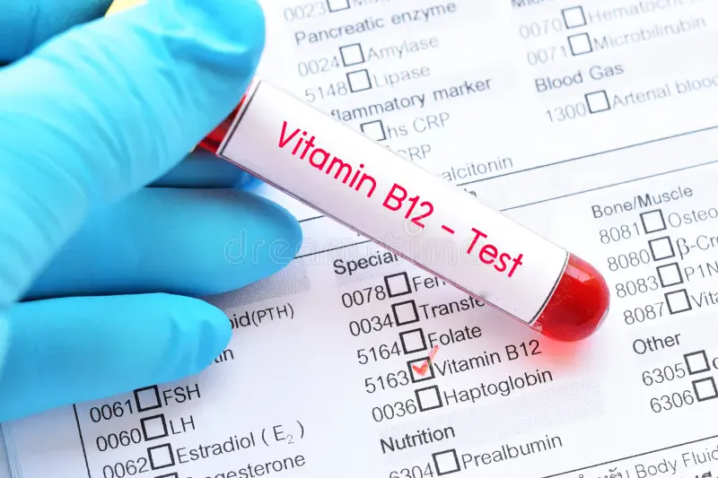 Vitamin B12 Test - DCDC