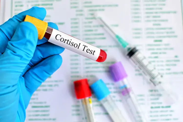 Cortisol Testing - DCDC