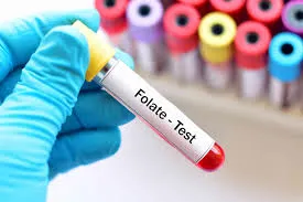 Folate Test - DCDC