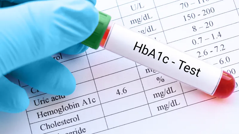 HbA1c Test - DCDC