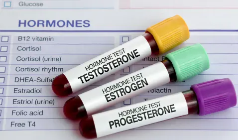 Male Hormone Panel - DCDC