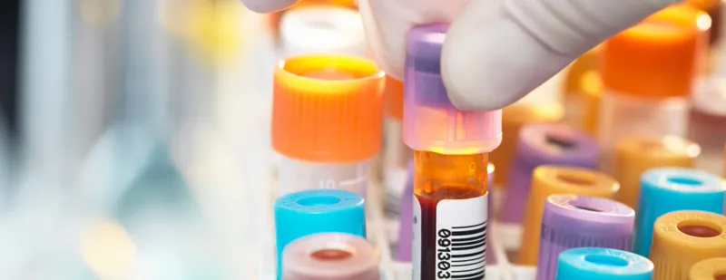 تست ویتامین - DCDC