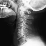 Digital neck X-ray showing cervical spine alignment at DCDC Dubai Healthcare City